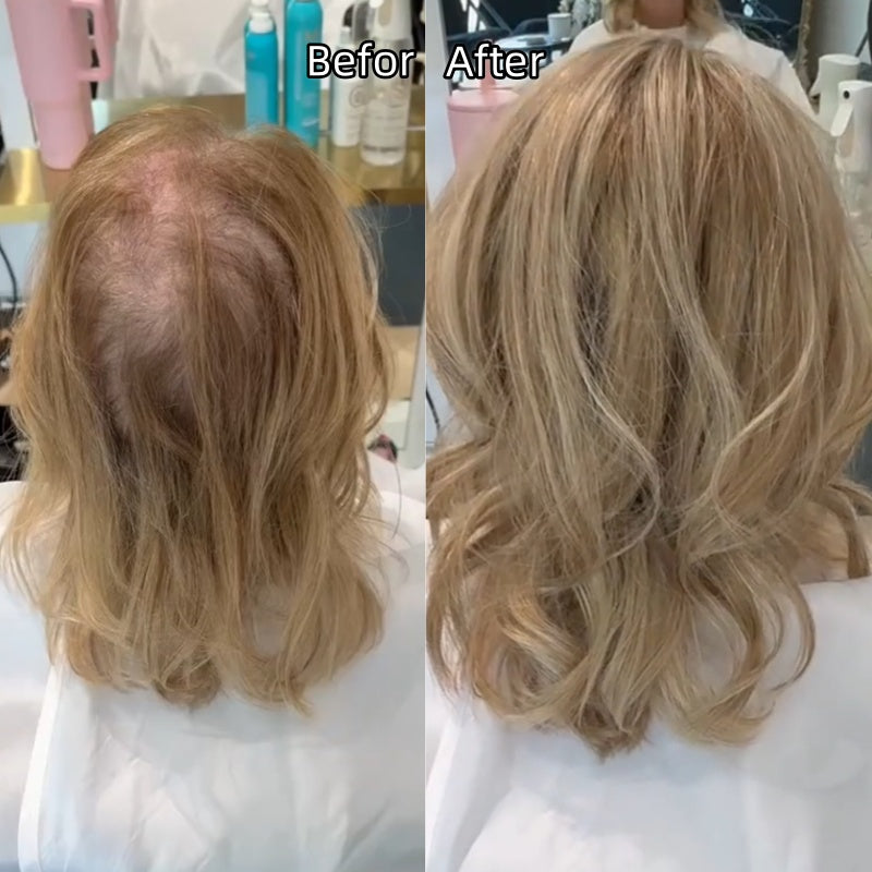 ⚡ Final Hours –💖2026 New Lightweight & Breathable Wavy Hair Topper